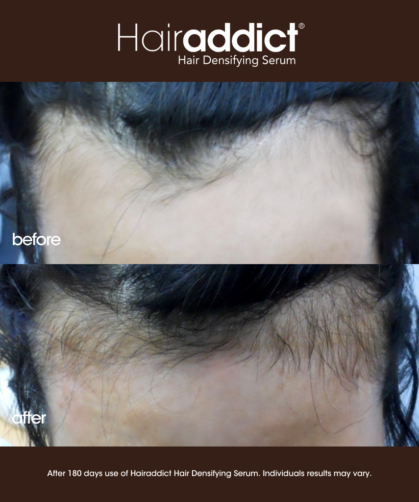 Hairaddict Hair Densifying Serum