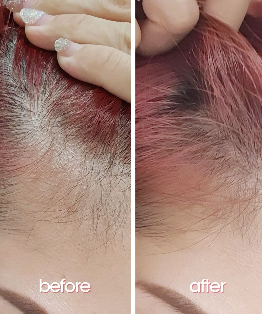 Hairaddict Hair Densifying Serum