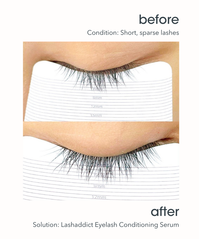 Lashaddict® Eyelash Conditioning Serum