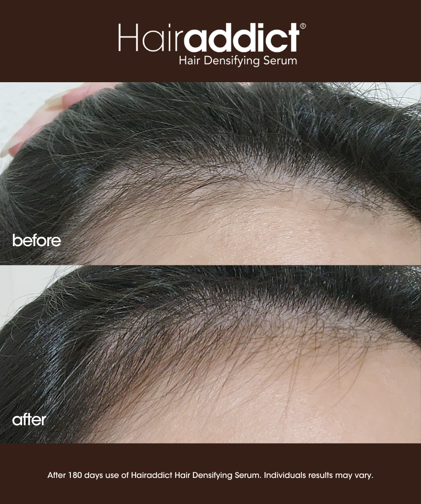 Hairaddict Hair Densifying Serum