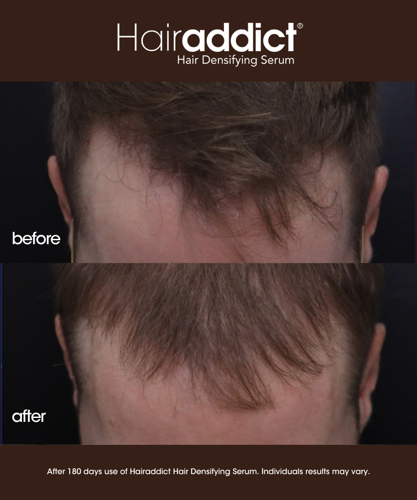 Hairaddict Hair Densifying Serum